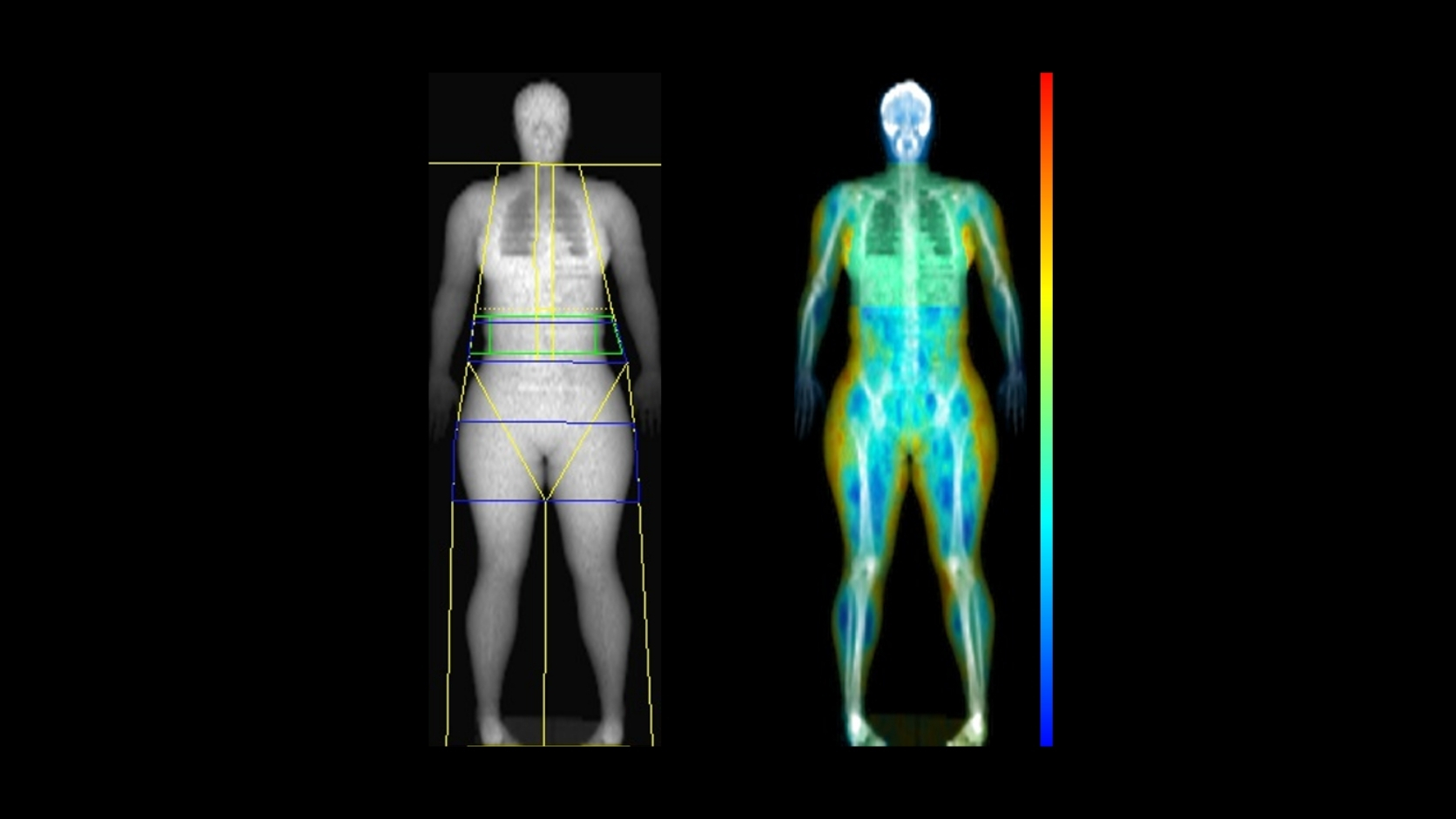 DEXA Scan Hero Section